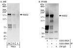 NSD2 Antibody in Western Blot (WB)