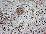 NT3 Antibody in Immunohistochemistry (Paraffin) (IHC (P))