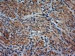 NT3 Antibody in Immunohistochemistry (Paraffin) (IHC (P))