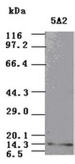 NT3 Antibody in Western Blot (WB)