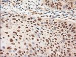 NT4 Antibody in Immunohistochemistry (Paraffin) (IHC (P))