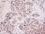 NT4 Antibody in Immunohistochemistry (Paraffin) (IHC (P))