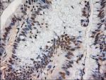 NT4 Antibody in Immunohistochemistry (Paraffin) (IHC (P))