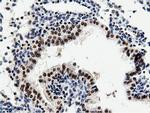 NT5DC1 Antibody in Immunohistochemistry (Paraffin) (IHC (P))