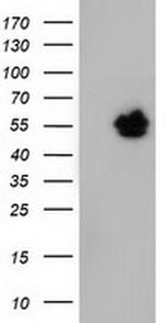 NT5DC1 Antibody in Western Blot (WB)