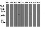 NT5DC1 Antibody in Western Blot (WB)