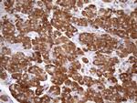 NT5E Antibody in Immunohistochemistry (Paraffin) (IHC (P))