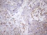 NT5E Antibody in Immunohistochemistry (Paraffin) (IHC (P))