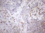 NT5E Antibody in Immunohistochemistry (Paraffin) (IHC (P))