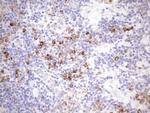 NT5E Antibody in Immunohistochemistry (Paraffin) (IHC (P))