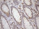 NT5E Antibody in Immunohistochemistry (Paraffin) (IHC (P))