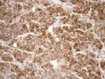 NT5E Antibody in Immunohistochemistry (Paraffin) (IHC (P))