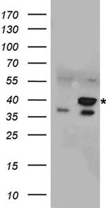 NTHL1 Antibody in Western Blot (WB)