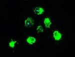 NTRK2 Antibody in Immunocytochemistry (ICC/IF)