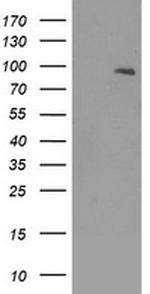 NTRK2 Antibody in Western Blot (WB)