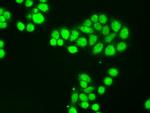 NTRK3 Antibody in Immunocytochemistry (ICC/IF)