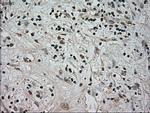 NTRK3 Antibody in Immunohistochemistry (Paraffin) (IHC (P))