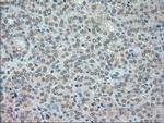 NTRK3 Antibody in Immunohistochemistry (Paraffin) (IHC (P))