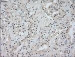 NTRK3 Antibody in Immunohistochemistry (Paraffin) (IHC (P))