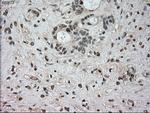 NTRK3 Antibody in Immunohistochemistry (Paraffin) (IHC (P))