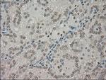 NTRK3 Antibody in Immunohistochemistry (Paraffin) (IHC (P))