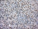 NTRK3 Antibody in Immunohistochemistry (Paraffin) (IHC (P))