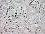 NTRK3 Antibody in Immunohistochemistry (Paraffin) (IHC (P))