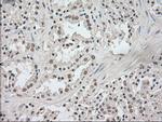 NTRK3 Antibody in Immunohistochemistry (Paraffin) (IHC (P))