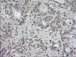 NTRK3 Antibody in Immunohistochemistry (Paraffin) (IHC (P))