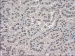 NTRK3 Antibody in Immunohistochemistry (Paraffin) (IHC (P))