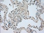 NTRK3 Antibody in Immunohistochemistry (Paraffin) (IHC (P))