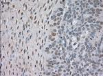 NTRK3 Antibody in Immunohistochemistry (Paraffin) (IHC (P))