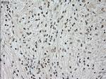 NTRK3 Antibody in Immunohistochemistry (Paraffin) (IHC (P))