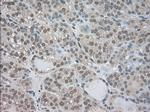 NTRK3 Antibody in Immunohistochemistry (Paraffin) (IHC (P))