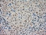 NTRK3 Antibody in Immunohistochemistry (Paraffin) (IHC (P))