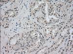 NTRK3 Antibody in Immunohistochemistry (Paraffin) (IHC (P))