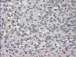 NTRK3 Antibody in Immunohistochemistry (Paraffin) (IHC (P))