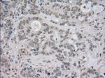 NTRK3 Antibody in Immunohistochemistry (Paraffin) (IHC (P))