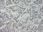 NTRK3 Antibody in Immunohistochemistry (Paraffin) (IHC (P))