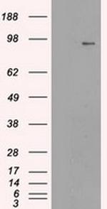 NTRK3 Antibody in Western Blot (WB)