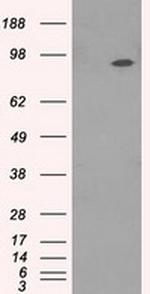 NTRK3 Antibody in Western Blot (WB)