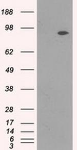 NTRK3 Antibody in Western Blot (WB)