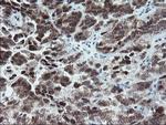 NUB1 Antibody in Immunohistochemistry (Paraffin) (IHC (P))