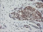 NUB1 Antibody in Immunohistochemistry (Paraffin) (IHC (P))