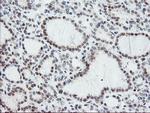 NUB1 Antibody in Immunohistochemistry (Paraffin) (IHC (P))