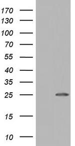 NUDT10 Antibody in Western Blot (WB)