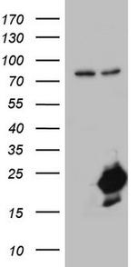 NUDT10 Antibody in Western Blot (WB)