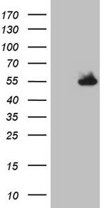 NUDT12 Antibody in Western Blot (WB)