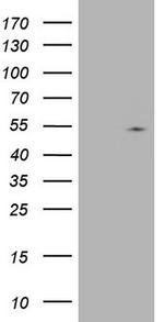 NUDT12 Antibody in Western Blot (WB)