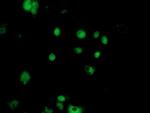 NUDT18 Antibody in Immunocytochemistry (ICC/IF)